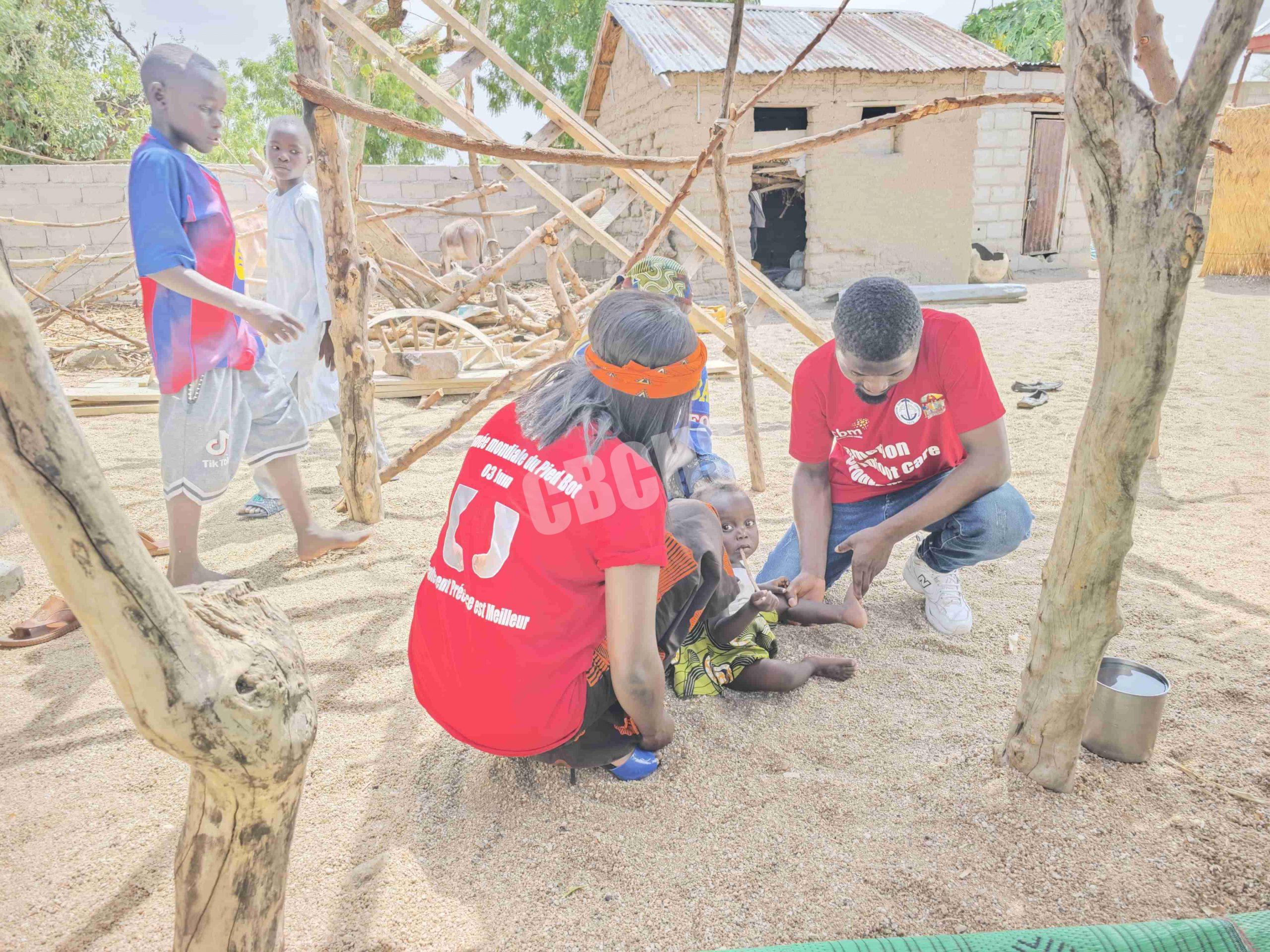 Clubfoot screening by physiotherapists in the community