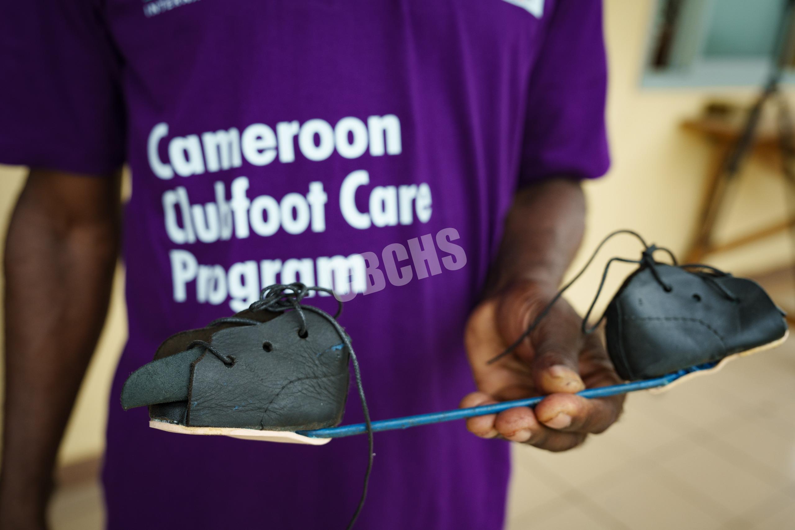 Foot abduction brace produced at the Clubfoot Workshop in Mutengene